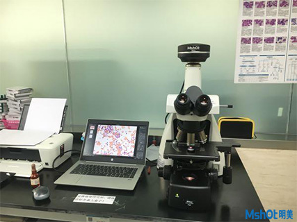 明美倒置熒光顯微鏡應用于骨髓觀察
