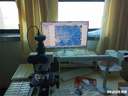 明美顯微鏡相機應用于教學案例爬片觀察
