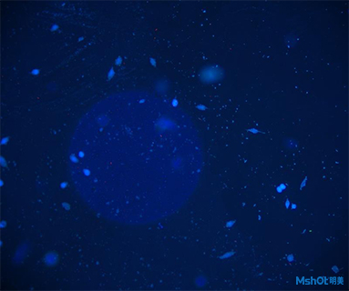 明美熒光顯微鏡應用于深圳市龍華中心醫院中心實驗室免疫細胞篩查