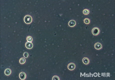 倒置顯微鏡下的酵母