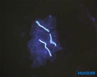 明美熒光顯微鏡應用于真菌檢測