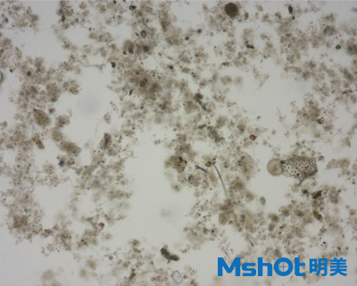 微擬球藻采用什么顯微鏡觀察？