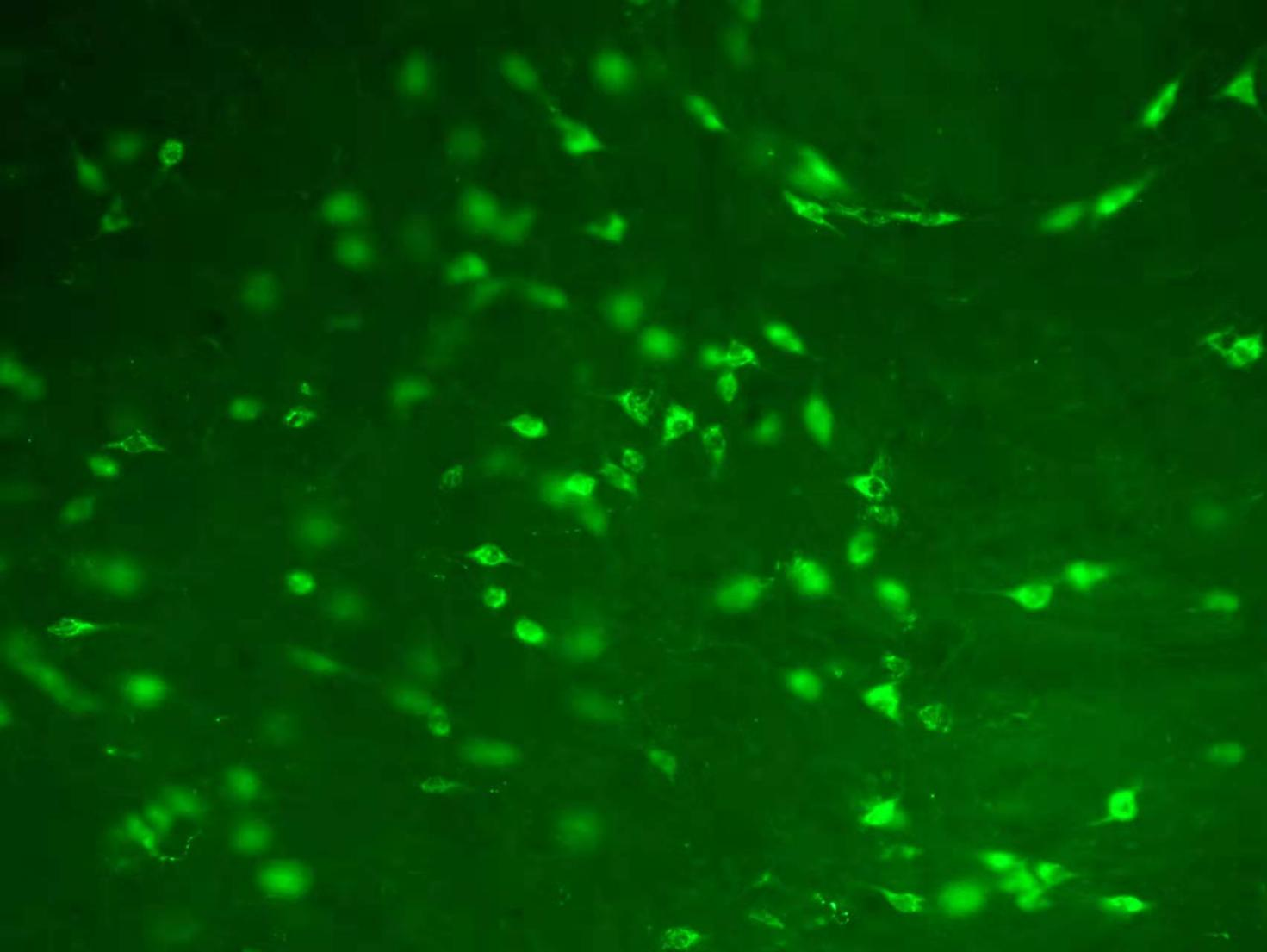 顯微鏡下的熒光蛋白